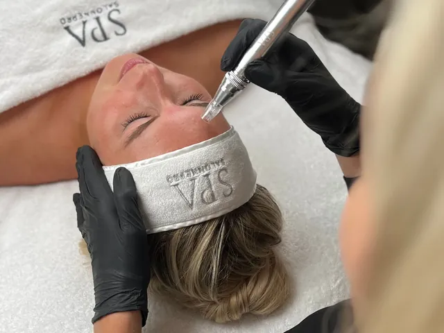 Microneedling: een gezicht wordt behandeld met een pen met minuscule naaldjes.
